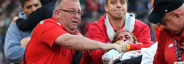 Woman suffers life-threatening injuries after being hit by broken bat at  Red Sox game – Orange County Register