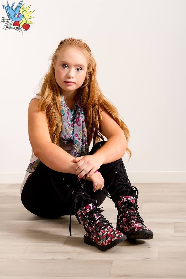 Meet The First Teen With Down Syndrome To Score A Modeling
