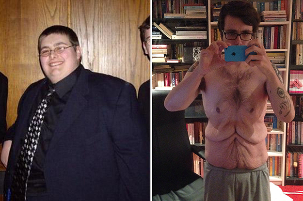 After Dropping 260 Pounds This Guy Decided To Share Photos Of His