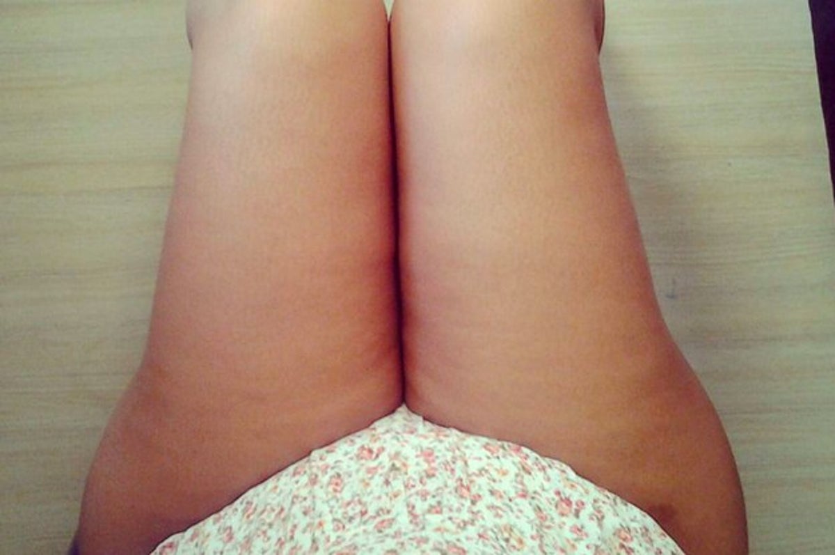 ThighReading pics sees women share their scars, stretch marks and