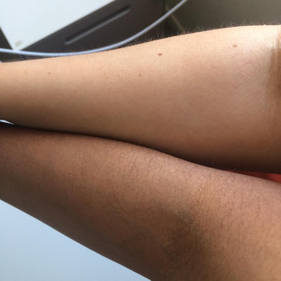 -_________-