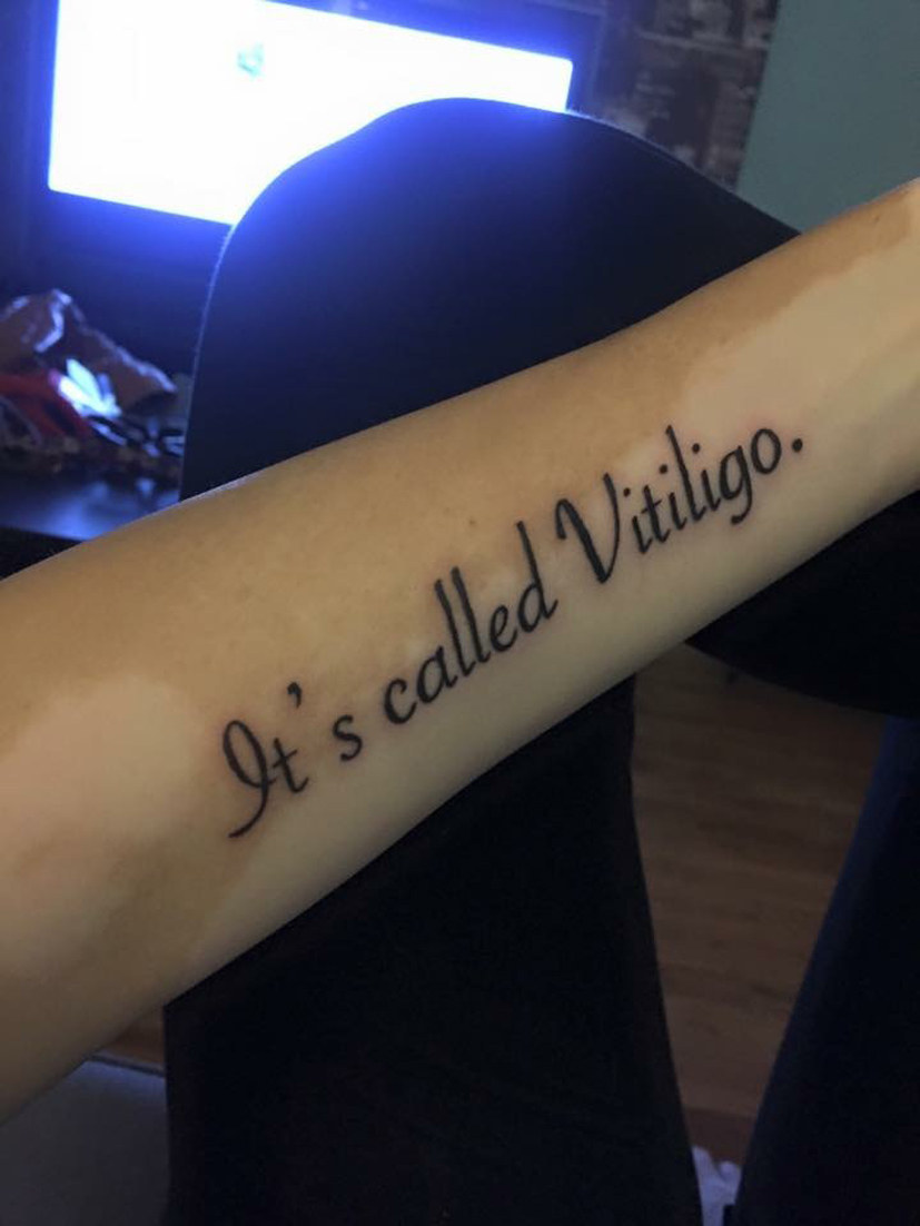 25 Vitiligo tattoo idéer  tatuering tatueringsidéer tatuering inspiration