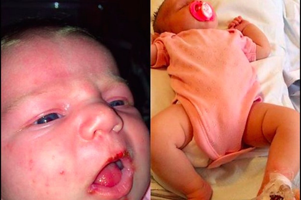 L Histoire De Cette Mere Montre Le Danger De Laisser Les Gens Embrasser Un Bebe L Histoire De Cette Mere Montre Le Danger De Laisser Les Gens Embrasser Un Bebe