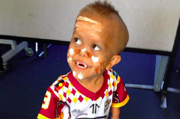 This Boy With Dwarfism Was The Victim Of Horrible Online 