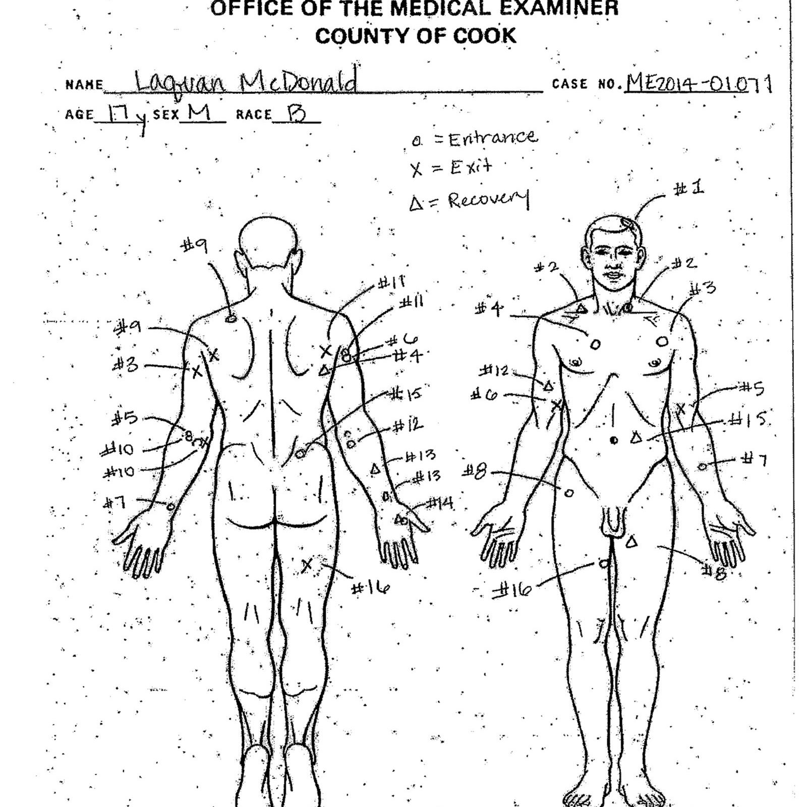 An autopsy diagram by the Cook County Medical Examiner&#x27;s office shows the location of wounds McDonald&#x27;s body.