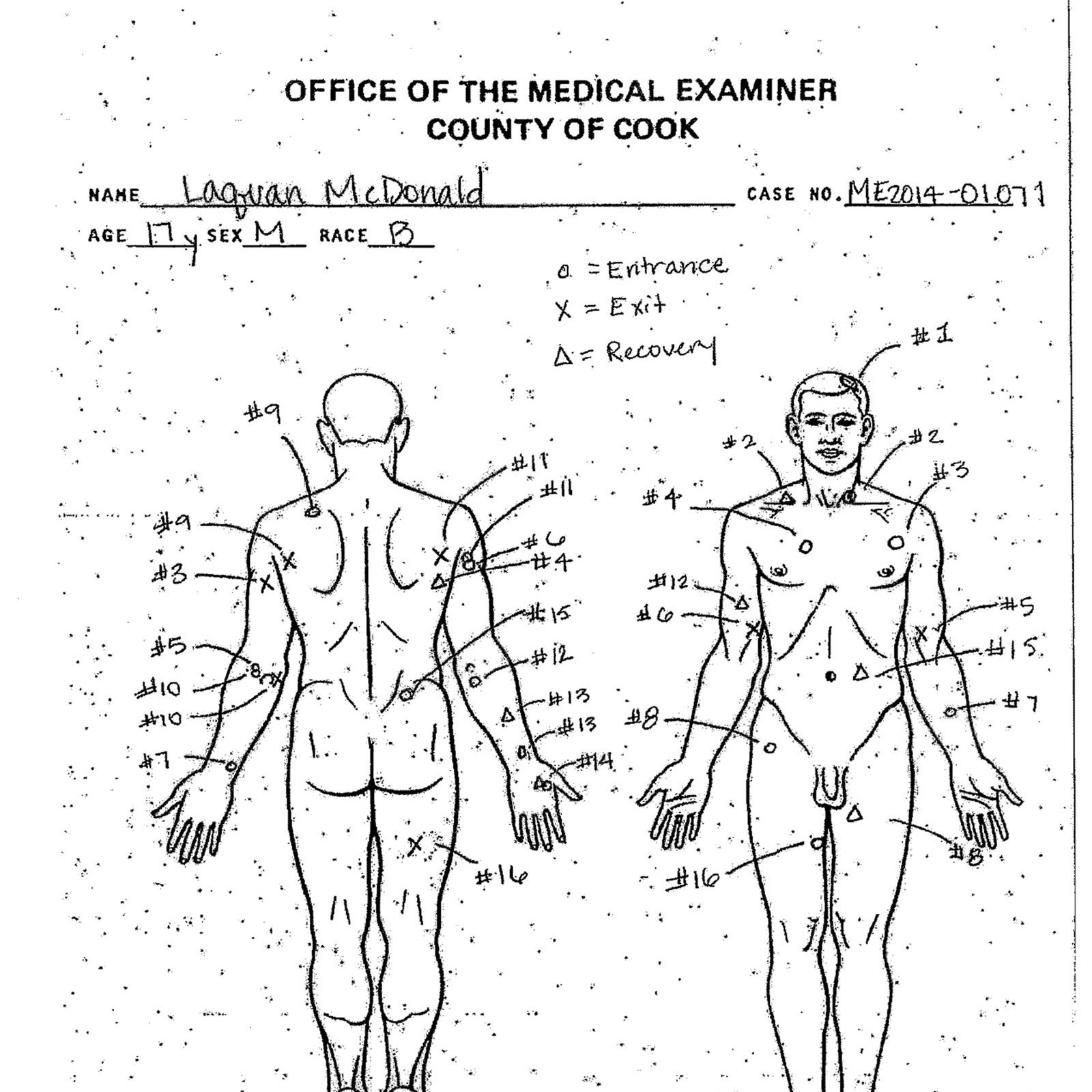 An autopsy diagram by the Cook County Medical Examiner&#x27;s office shows the location of wounds McDonald&#x27;s body.