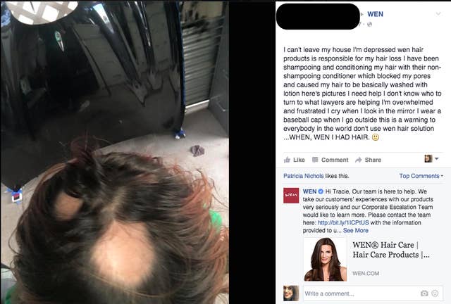 Women Say Their Hair Is Falling Out In Chunks After Using Wen Hair