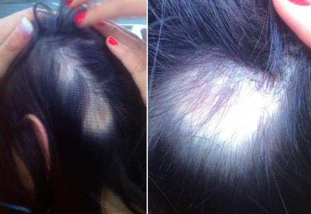 Women Say Their Hair Is Falling Out In Chunks After Using Wen Hair