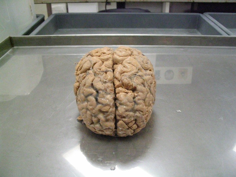 Какой вес мозга человека. Настоящий человеческий мозг. Вес головного мозга человека.
