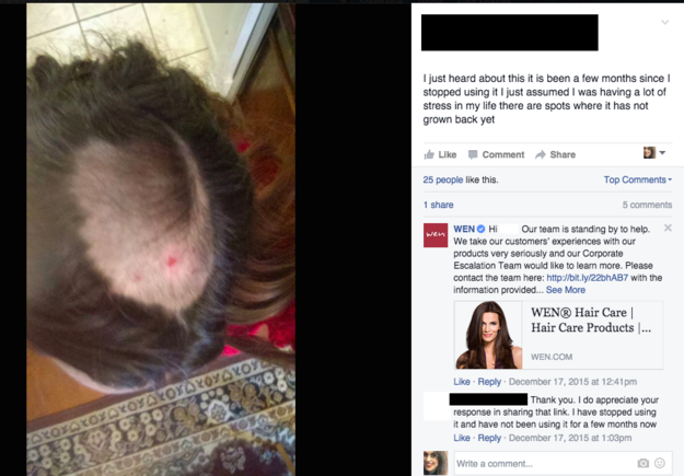 White Women Have Discovered A Breakthrough In Hair Care Check