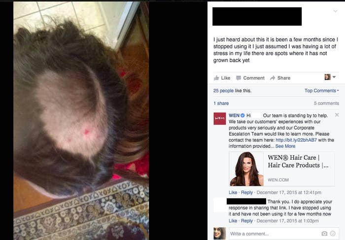 Wen Hair Loss Accusations Business Insider