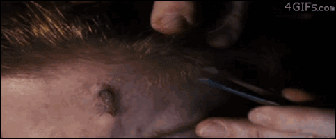 Thing vs. tweezers!