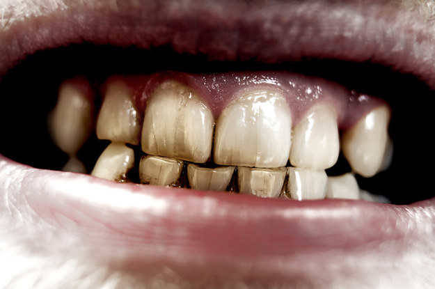 Tamara-Baez-se-puso-cristales-en-los-dientes--como-evitar-caries.htm
