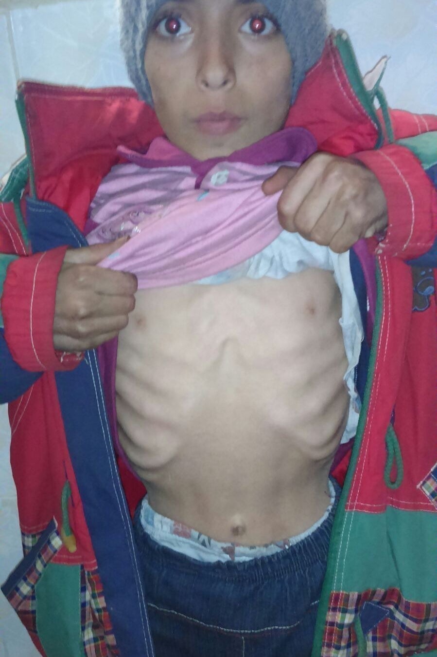 Thousands in Madaya face starvation.