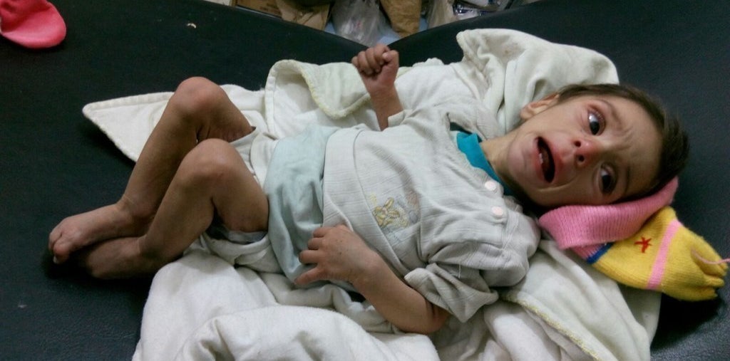 A malnourished child photographed by doctors in Madaya. An estimated 393,700 people in Syria are besieged.