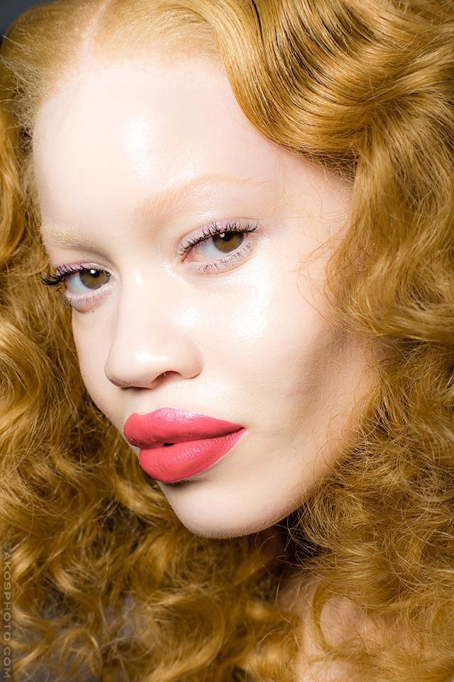 Diandra Forrest est déjà très connue dans le milieu de la mode pour être le premier mannequin albinos à signer avec une grande agence de mannequins. Son combat pour une société ouverte à l'albinisme l'a aussi aidée à se démarquer des autres mannequins de sa génération.