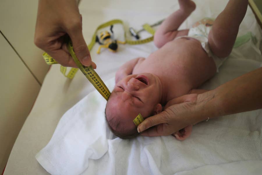 Here S What You Need To Know About The Zika Virus And Microcephaly