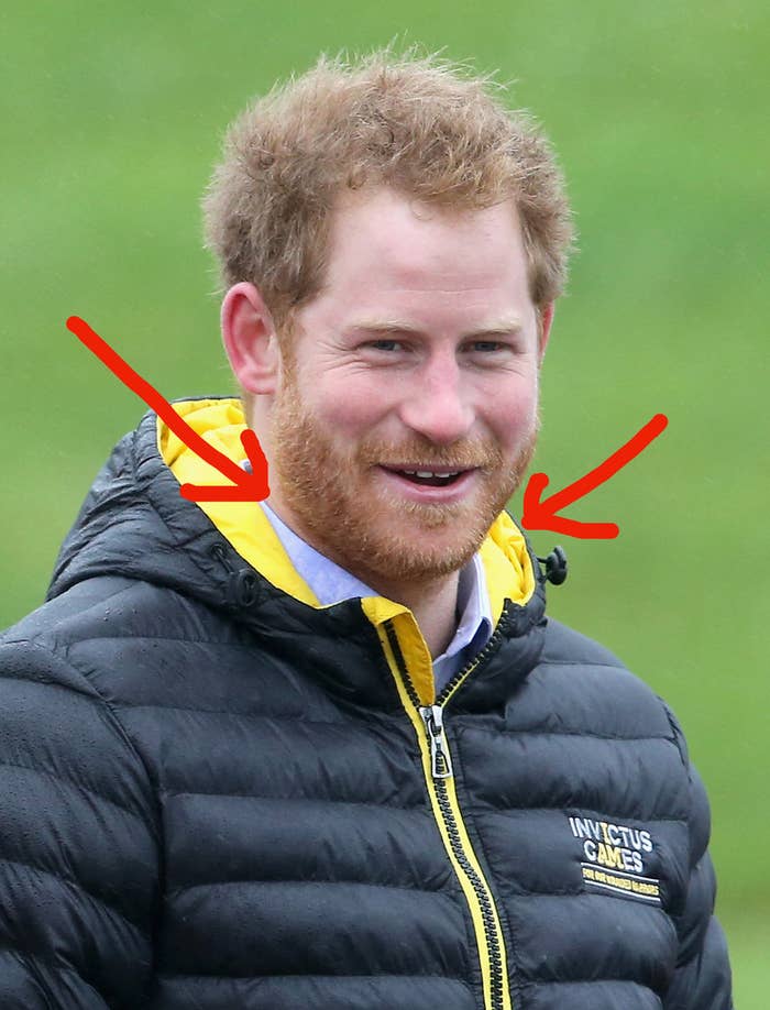 Hello, tinge of ginge, my name is, Marry Me?