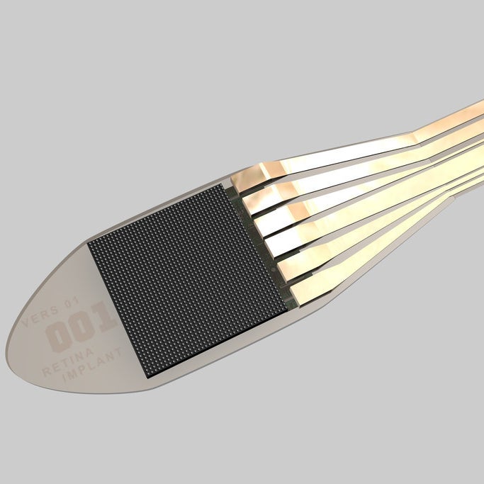 The small electronic chip implanted at the back of the retina to replace damaged photoreceptors.