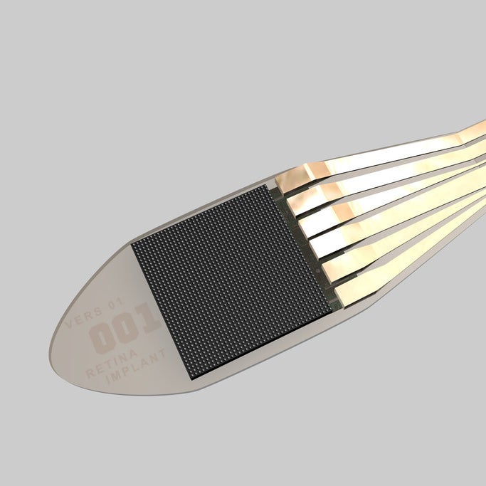 The small electronic chip implanted at the back of the retina to replace damaged photoreceptors.