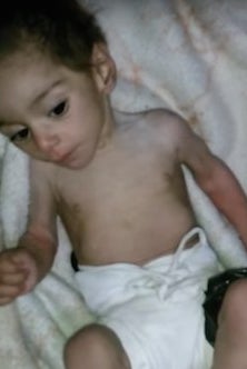 Hala Alhadad, a seven-month-old girl