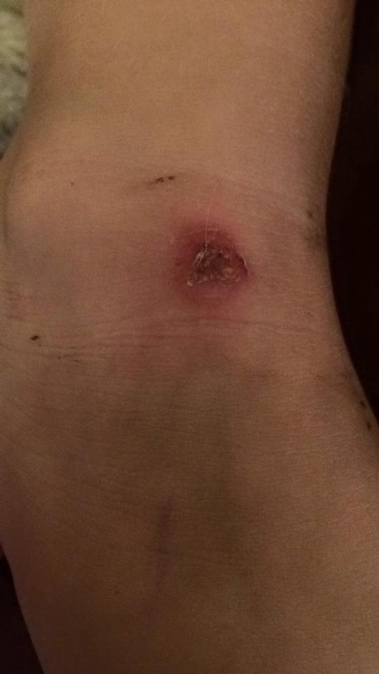 maxbulk mailer infection maxbulk mailer infection