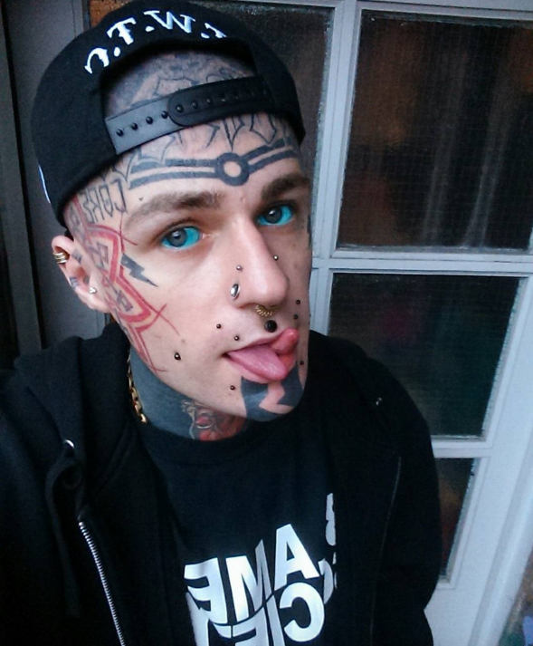 Eyeball Tattoo Leaves Model In Pain And Partially Blind