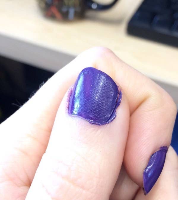 22 Photos That Won T Make Sense To People With Perfect Nails