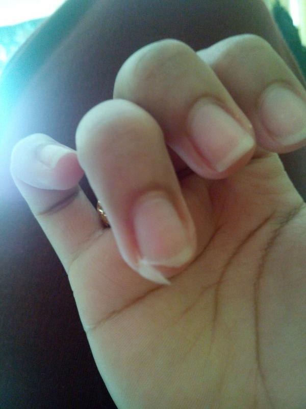 22 Photos That Won't Make Sense To People With Perfect Nails
