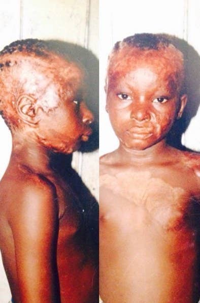 This Burn Survivor Shares The Most Incredible Makeup Tips With A Truly Inspiring Message