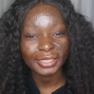 This Burn Survivor Transforms Herself With Makeup And It S Incredible