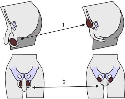 How To Tuck Your Balls