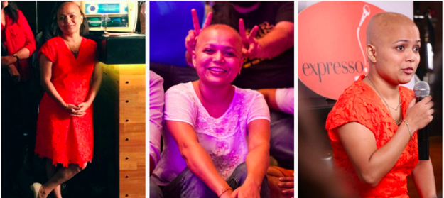 The Long, Brave Journey From Alopecia To Acceptance - image enhanced-8695-1457526035-1 on https://purewigs.com