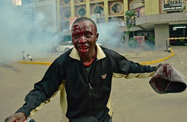 The photos were taken at an electoral reform demonstration on Monday, where one protester was pictured fleeing with blood pouring out of a gash on his forehead and running down his face, as police fired tear gas and wielded truncheons.