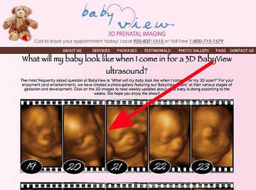 Parents Accuse This Ultrasound Clinic Of Recycling Images