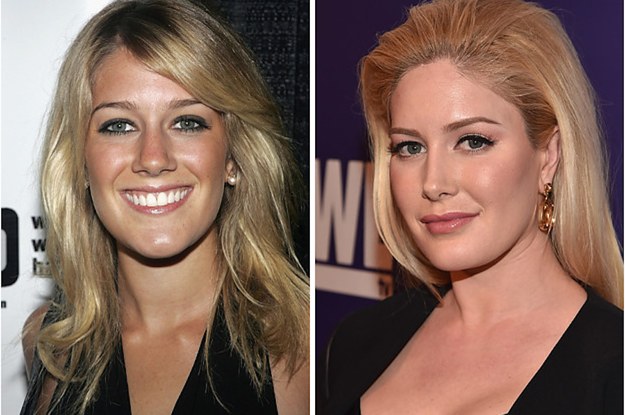 The Hills Cast Before And After Beauty Transformations