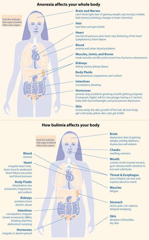 A Life Without Anorexia Consequences Of Eating Disorders