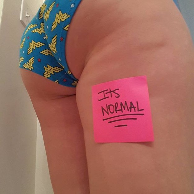 Fact: Cellulite is totally normal, and you can be any size or shape and have it.