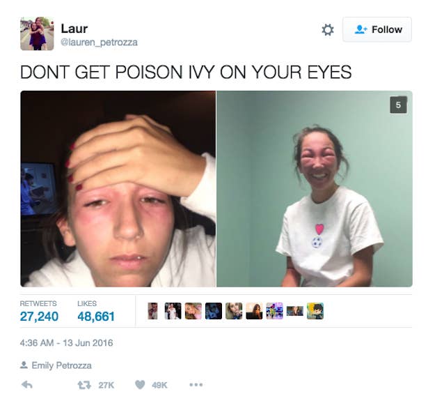 Image result for girl with swollen face meme