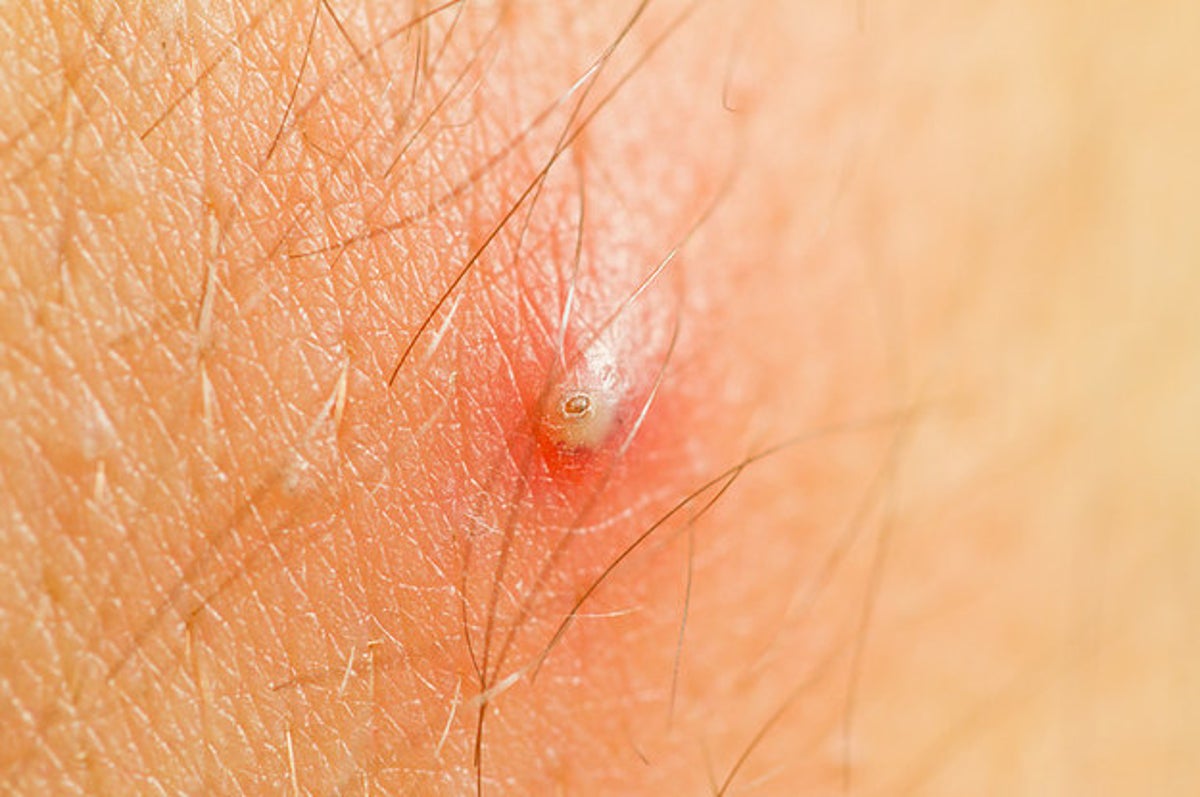 17 Annoying Body Things You Almost Can't Resist Touching