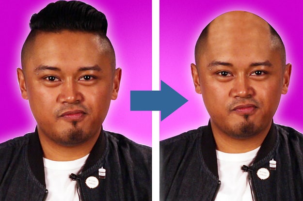 Men Find Out If They'll Lose Their Hair