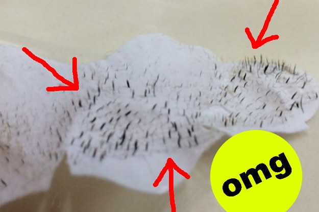 17 Oddly Satisfying Pictures Of Used Pore Strips
