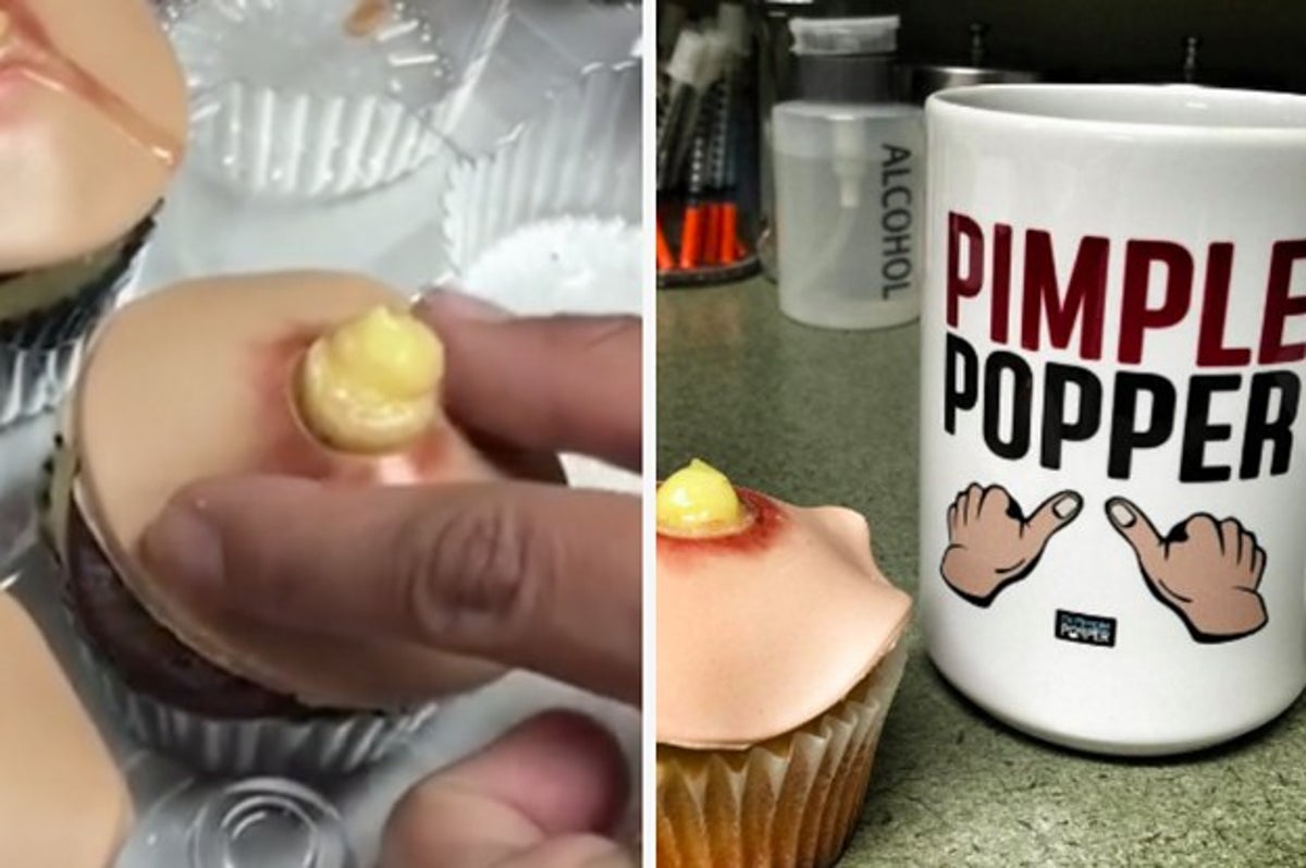 Het pad Beschaven wastafel A Baker Invented Pimple Cupcakes That Pop When You Squeeze 'Em
