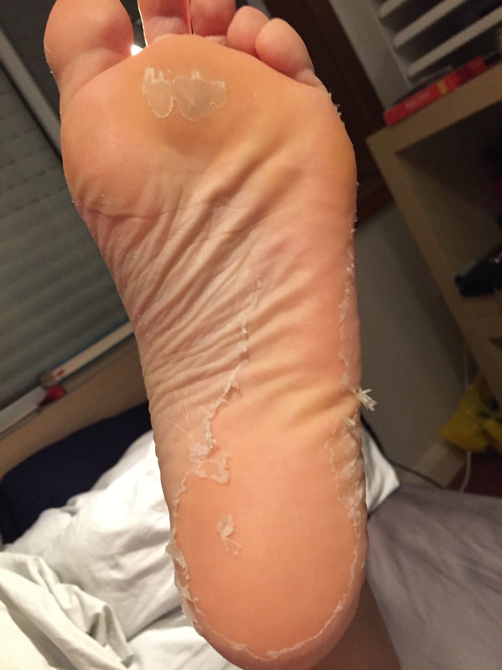 I Tried This Insane Foot Peel Kit And Here's What Happened