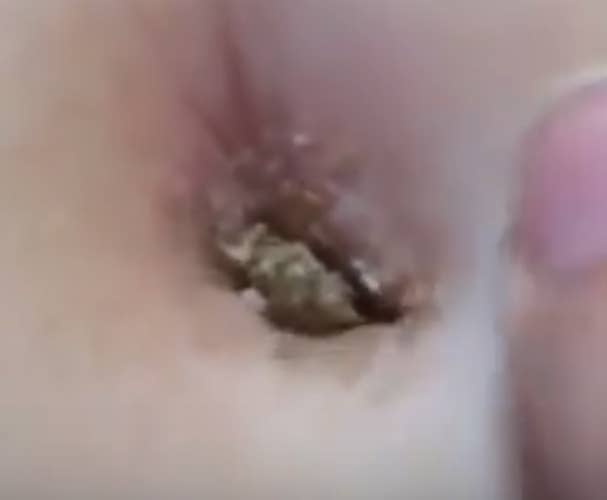 What The Fuck Is This Thing A Woman Pulled Out Of Her Sister's Belly Button