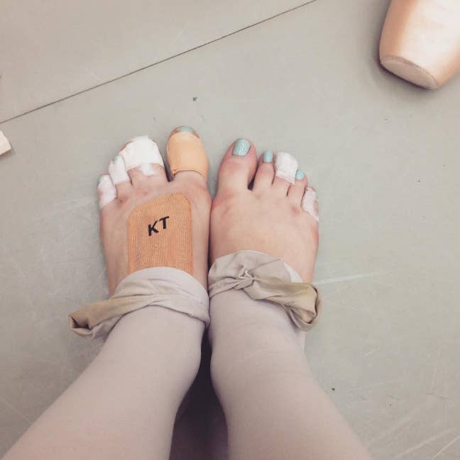 18 Imagenes Que Prueban Que El Ballet Es El Arte Mas Extremo Del Mundo