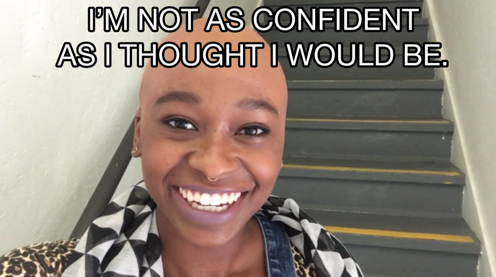 These Ladies Went Bald For A Day And Stunted So Hard
