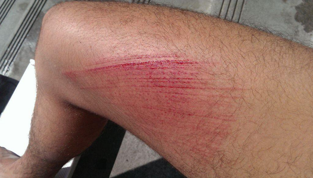 And scrapes...