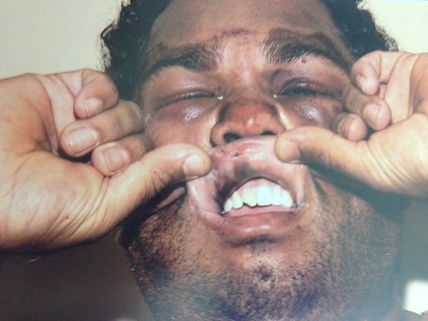 An Aboriginal man claims he was the victim of a brutal police bashing in Queensland that left him with horrific injuries and ongoing mental anguish.