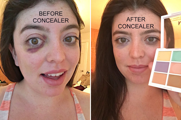 A person with a black eye and a person with a barely visible black eye after using the colour-correcting palette